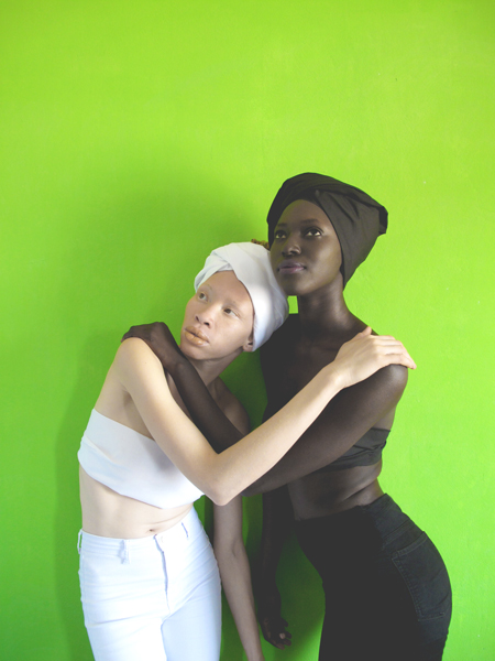 albinos-melanine-art-artiste-ambrecardinal-blancdebene-mode-directionartistique